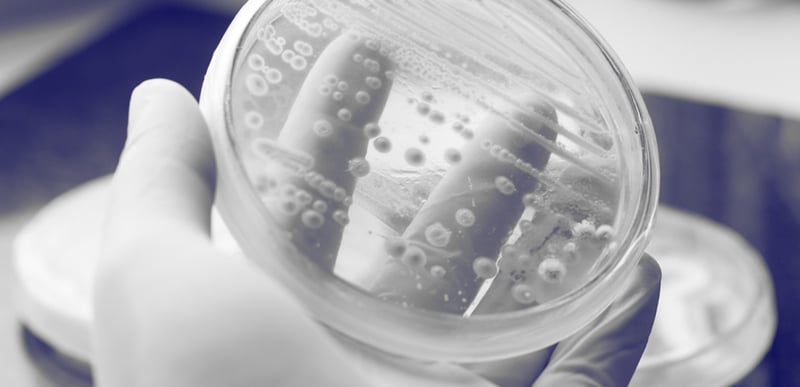 QPS status: the golden standard of microorganism safety evaluation